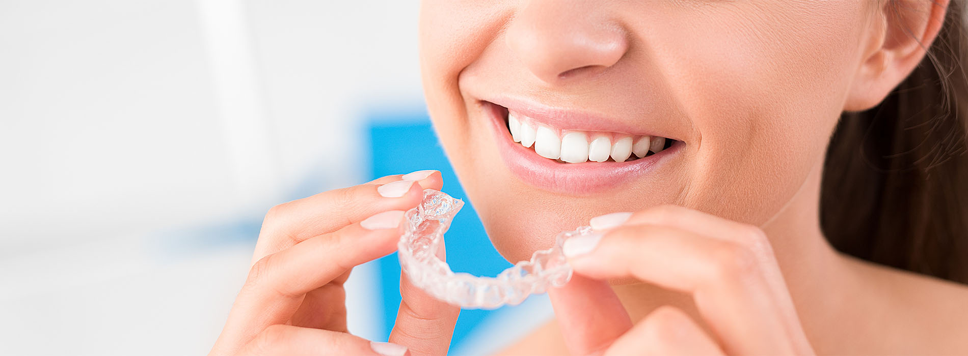 Wie funktioniert eine Aligner-Therapie?