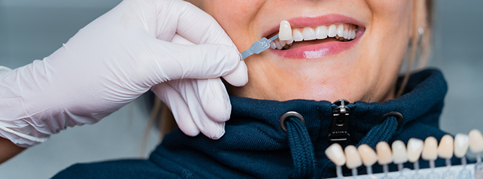 zahnaufhellung-duesseldorf