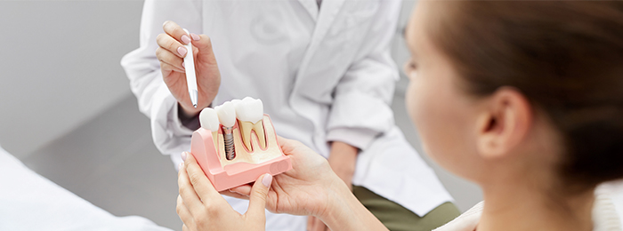 zahnimplantate-in-duesseldorf